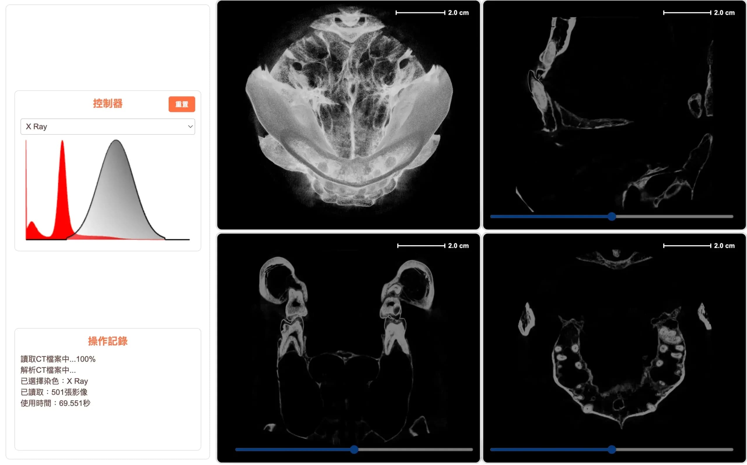 病歷分析管理系統 + CT 電腦斷層解決方案 - 1